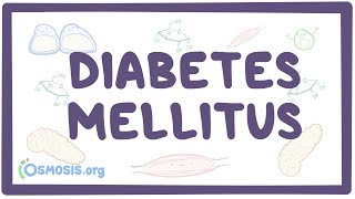 Diabetes mellitus type 1 type 2 amp diabetic ketoacidosis DKA [upl. by Melisandra]