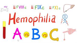 Hemophilia Types  hemophilia A Hemophilia B and Hemophilia C  Comparison  Genetics Hematology [upl. by Biagio]