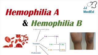 Hemophilia A vs Hemophilia B  Genetics Symptoms and Treatment [upl. by Nelaf]