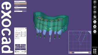 exocad Video Tutorial Model Creator [upl. by Lemra595]