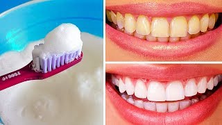 10 Natural Ways to Whiten Teeth at Home [upl. by Elnore574]