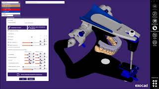 Prosystom  Exocad  Bite splint Functional [upl. by Retse]