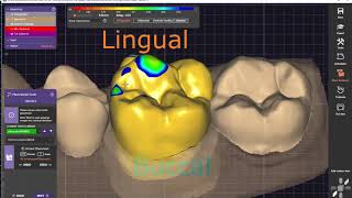 Exocad Tutorial Episode 1 [upl. by Ramsay]