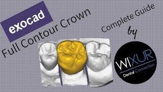 Exocad  Full Contour Crown Design [upl. by Su]