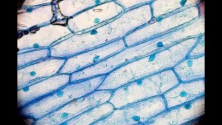 സസ്യകോശം  Plant cell I ILLIAS PERIMBALAM I Science Malayalam [upl. by Notgnirrab235]