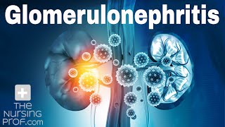 Renal Emergencies Glomerulonephritis [upl. by Saffier]