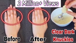 How To Remove Tan From FaceNeckHandsKnees Overnight Simple home remedie [upl. by Bruell]