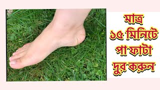 how to remove dead skin from your feet naturally at home 2021 cracked heels home remedy [upl. by Wally]