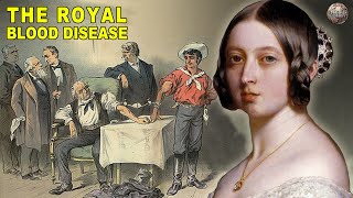 All About Hemophilia The Royal Blood Disease [upl. by Hairabez]