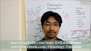 Haemophilia  Definition Types Pathogenesis Clinical Features Diagnosis Treatment  HD [upl. by Musa]