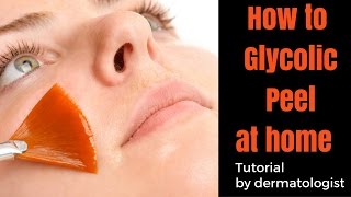 How to Glycolic Peel at HOME [upl. by Kariotta]