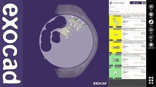 exocad Video Tutorial basic exocam [upl. by Nnayelsel550]